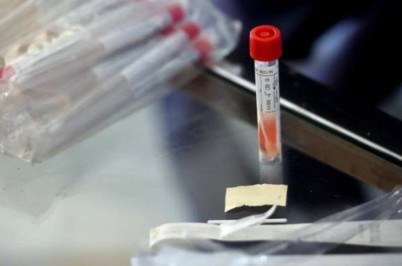 Американські чиновники схвалили перший тест на коронавірус в домашніх умовах