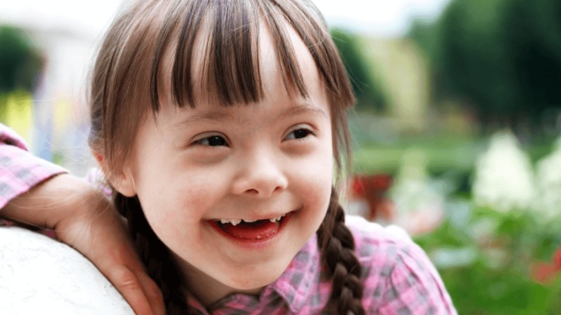 Маленька українка з синдромом Дауна — відома у світі фотомодель