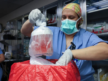 Американські хірурги вперше пересадили живій людині нирку свині