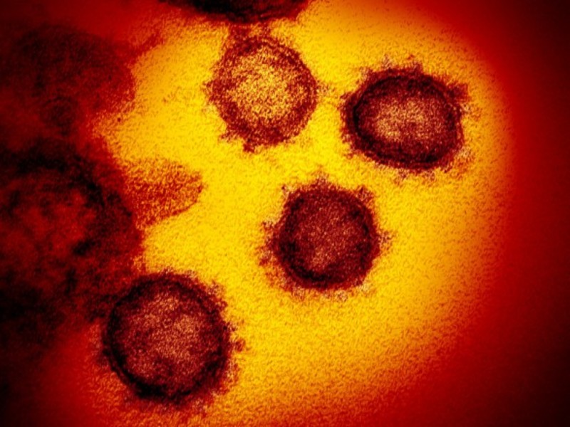 Учені показали, як коронавірус виглядає під мікроскопом