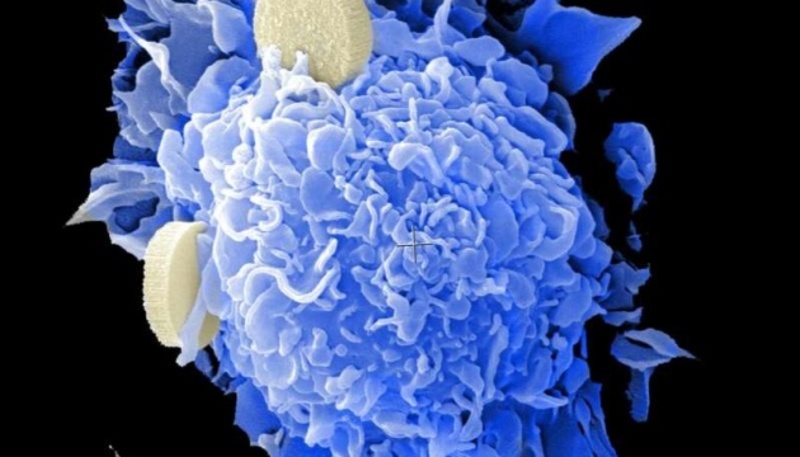 В організмі людини виявили речовину, що знищує ракові клітини