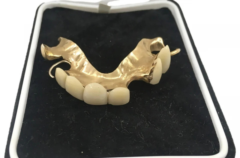 У Британії виставлять на аукціон золотий зубний протез Черчилля: стартова ціна — $10 тисяч