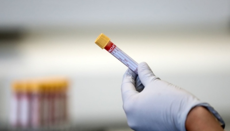 У Штатах виявили понад 25 мільйонів випадків коронавірусу
