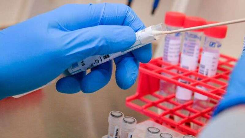 У США схвалили перший тест, що може виявити коронавірус за 45 хвилин