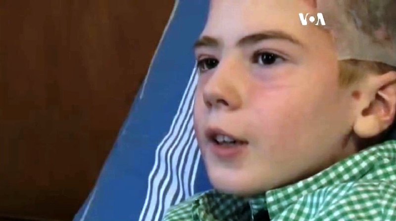 Лікарі з Бостона врятували українського хлопчика, в якого не було шансів вижити
