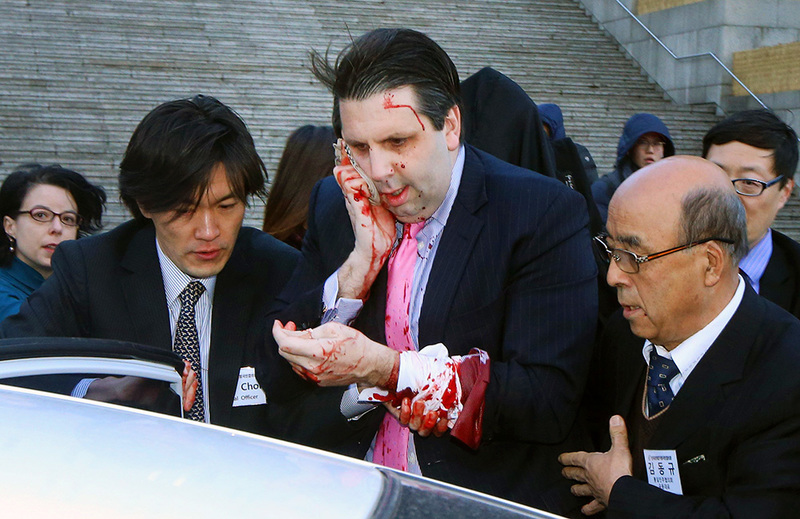 На посла США у Південній Кореї напали з бритвою (фото)