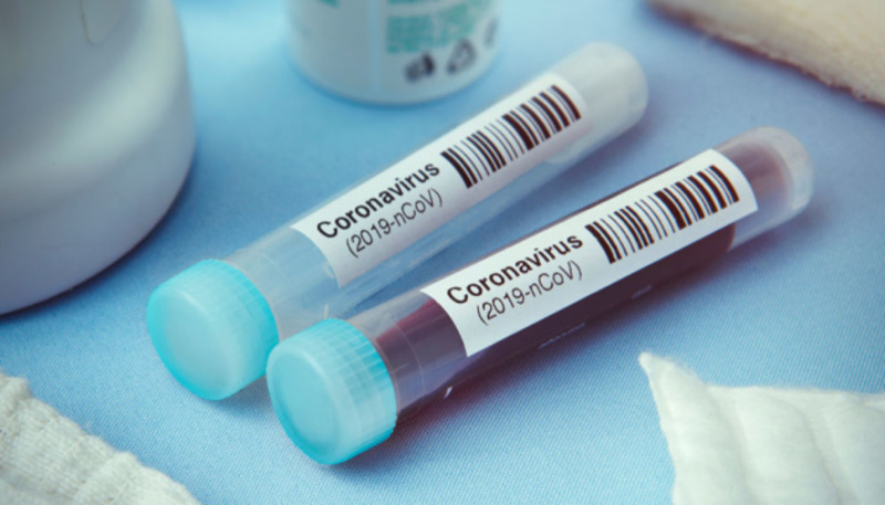 Україна в ТОП-10 «лідерів» поширення коронавірусу у світі